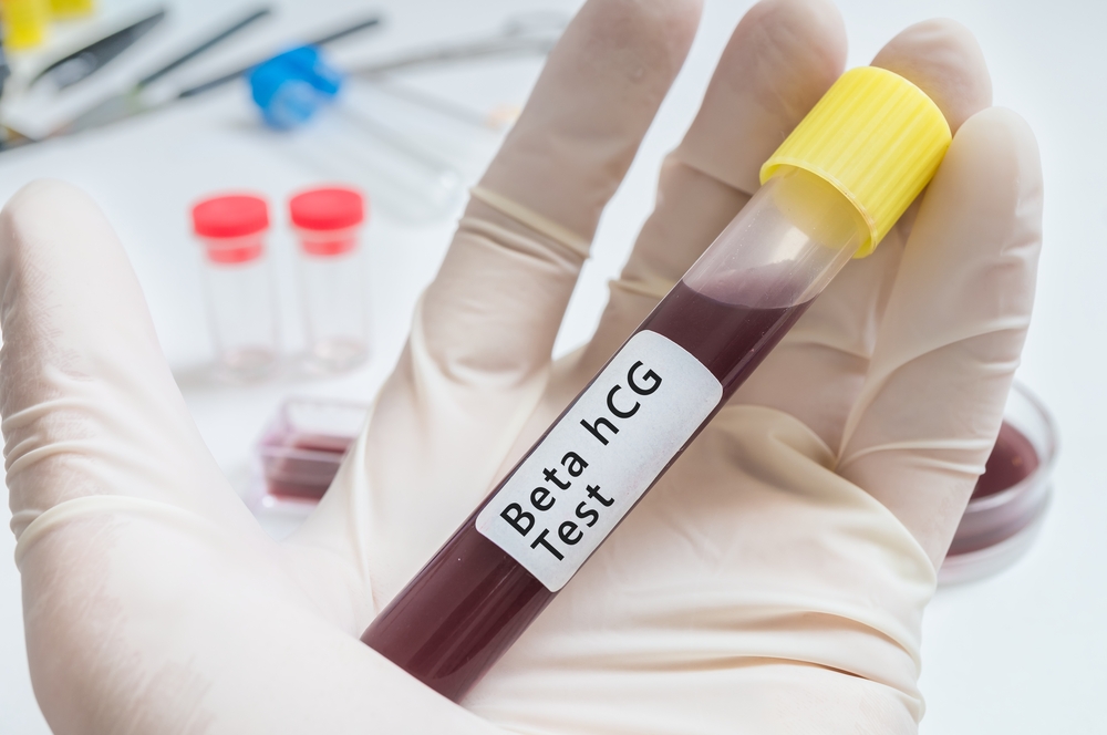 blood for pregnancy Tests