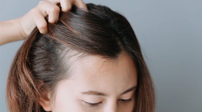 Understanding Postpartum Hair Loss