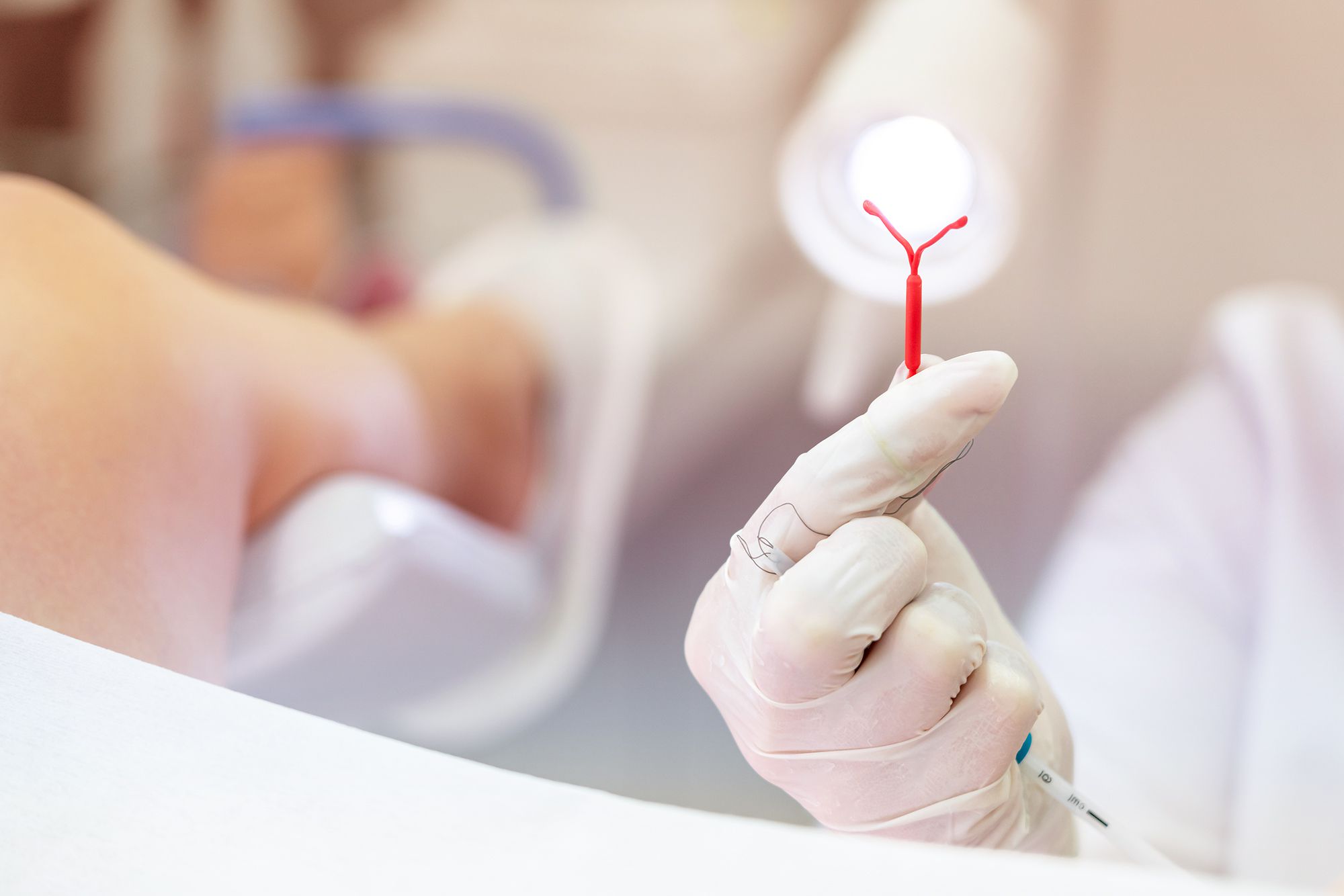 How to Switch from the Pill to an IUD