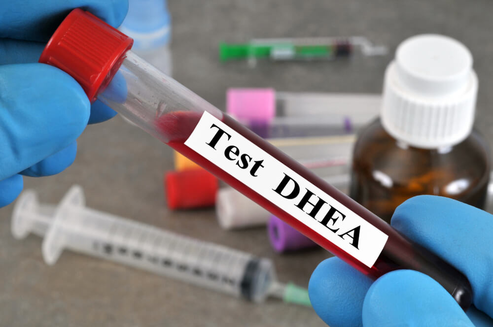 DHEA hormone test