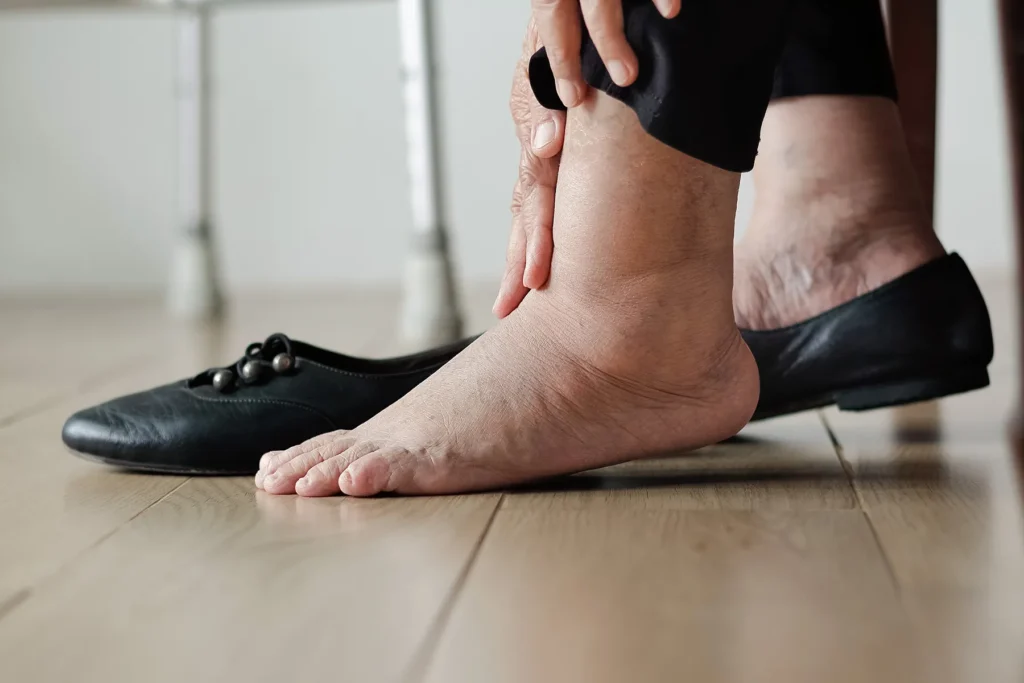 man experiencing edema after testosterone therapy