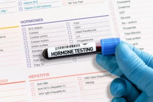 How Often Should Men Get Hormone Levels Checked?