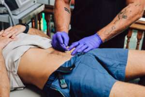 Will Pelvic Floor Therapy Help with Hard Flaccid?