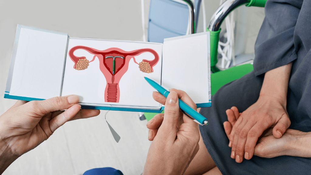 doctor trying to explain how an IUD works