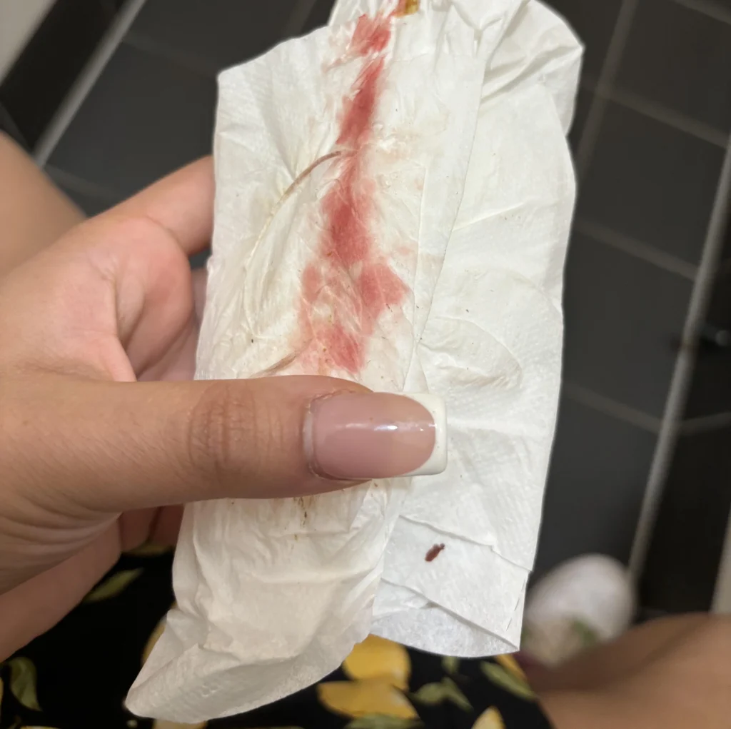 Spotting on the tissue
