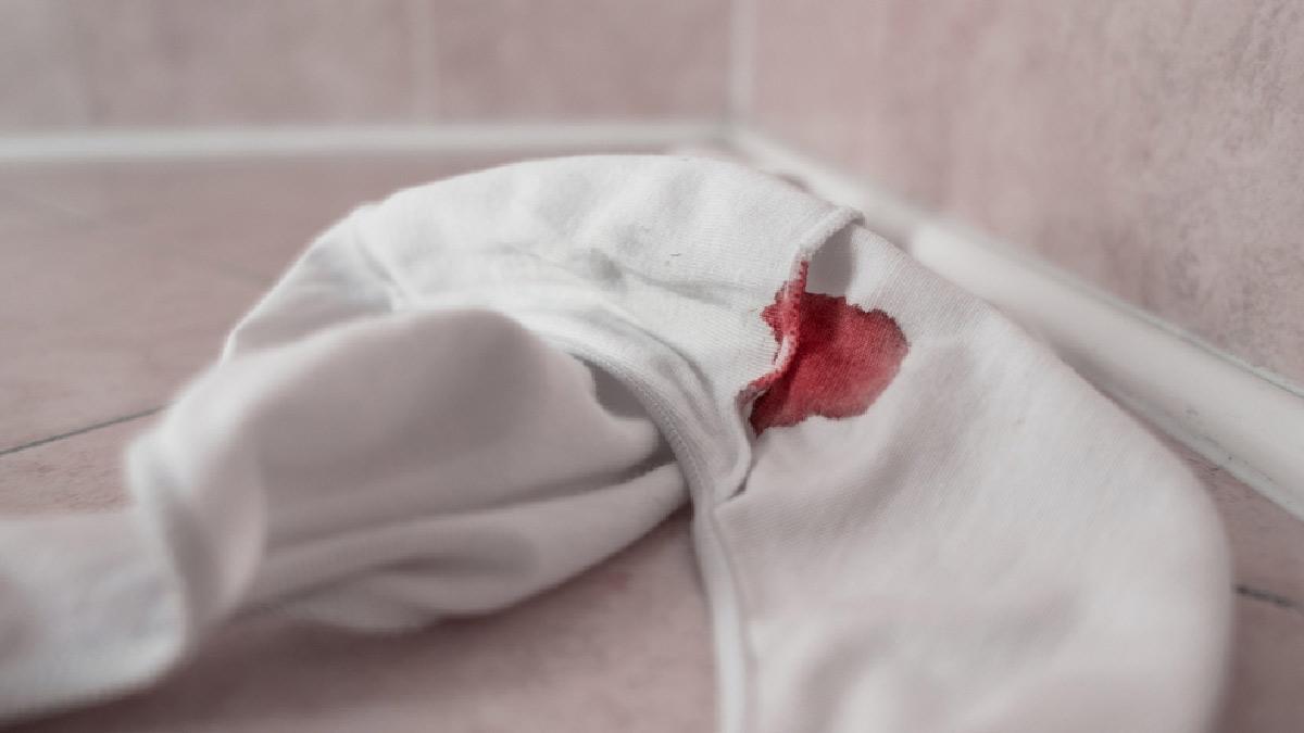Why Am I Spotting After Unprotected Sex?