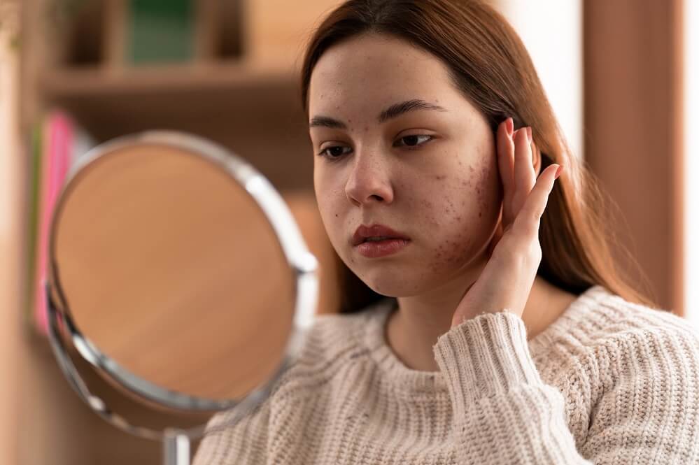 young lady checking for hyperpigmentation