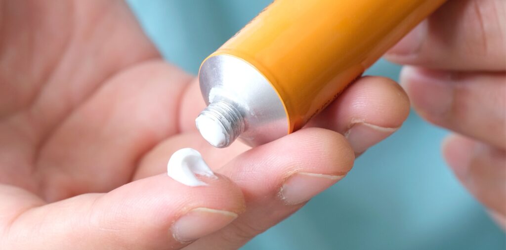 Topical Corticosteroid Creams