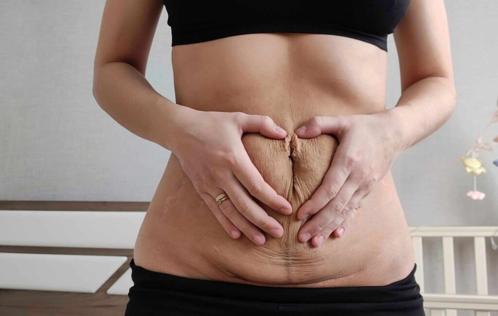 Postpartum Weight Loss
