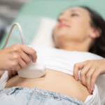Can You Have PCOS Without Cysts on Ultrasound?