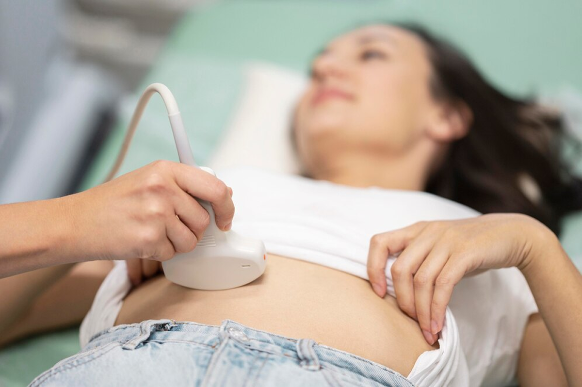 Can You Have PCOS Without Cysts on Ultrasound?