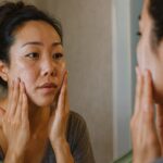 How to Tell PCOS Acne from Regular Hormonal Acne