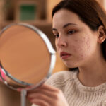 Best Natural Solutions to PCOS Hair Growth: Effective Ways to Manage Excess Hair Naturally